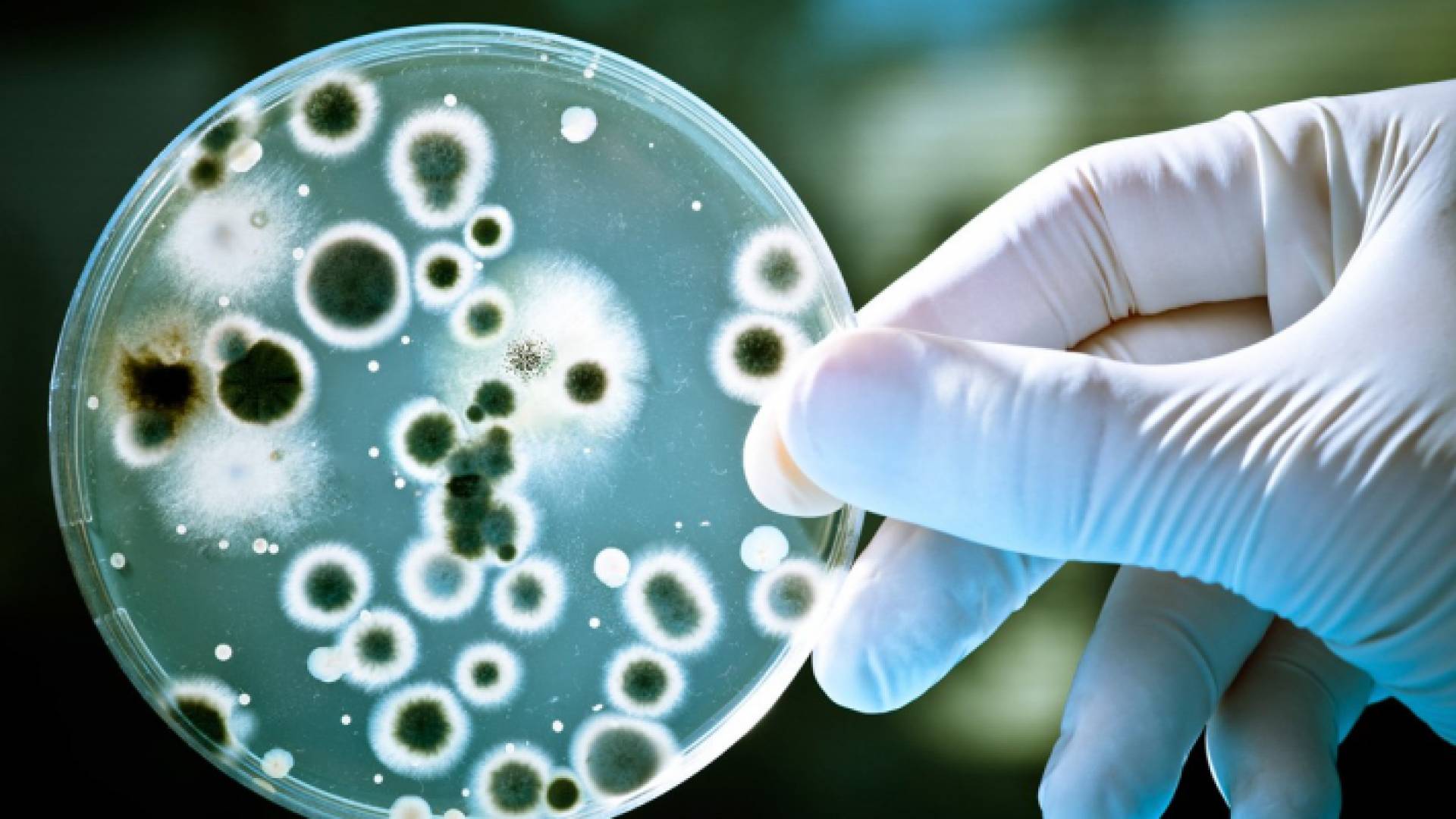 أحد أنواع البكتيريا