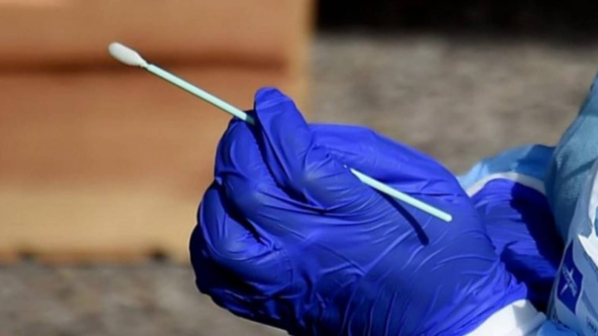 فحص كورونا - ارشيفية