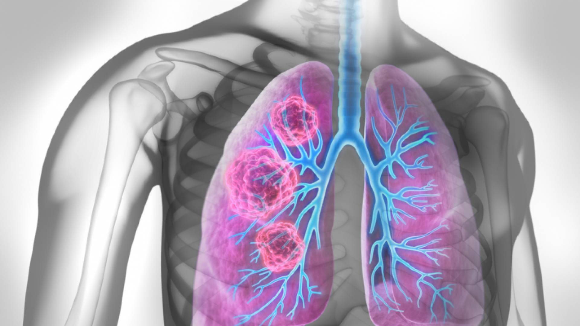 صورة تعبيرية للرئتين