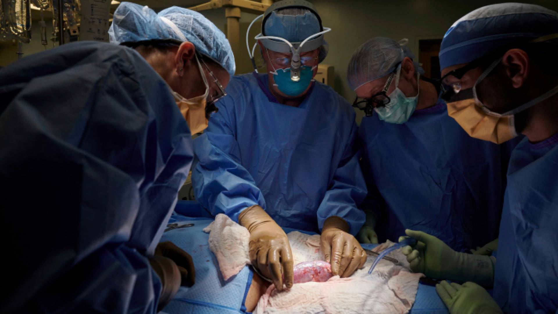 خلال إجراء العملية الجراحية