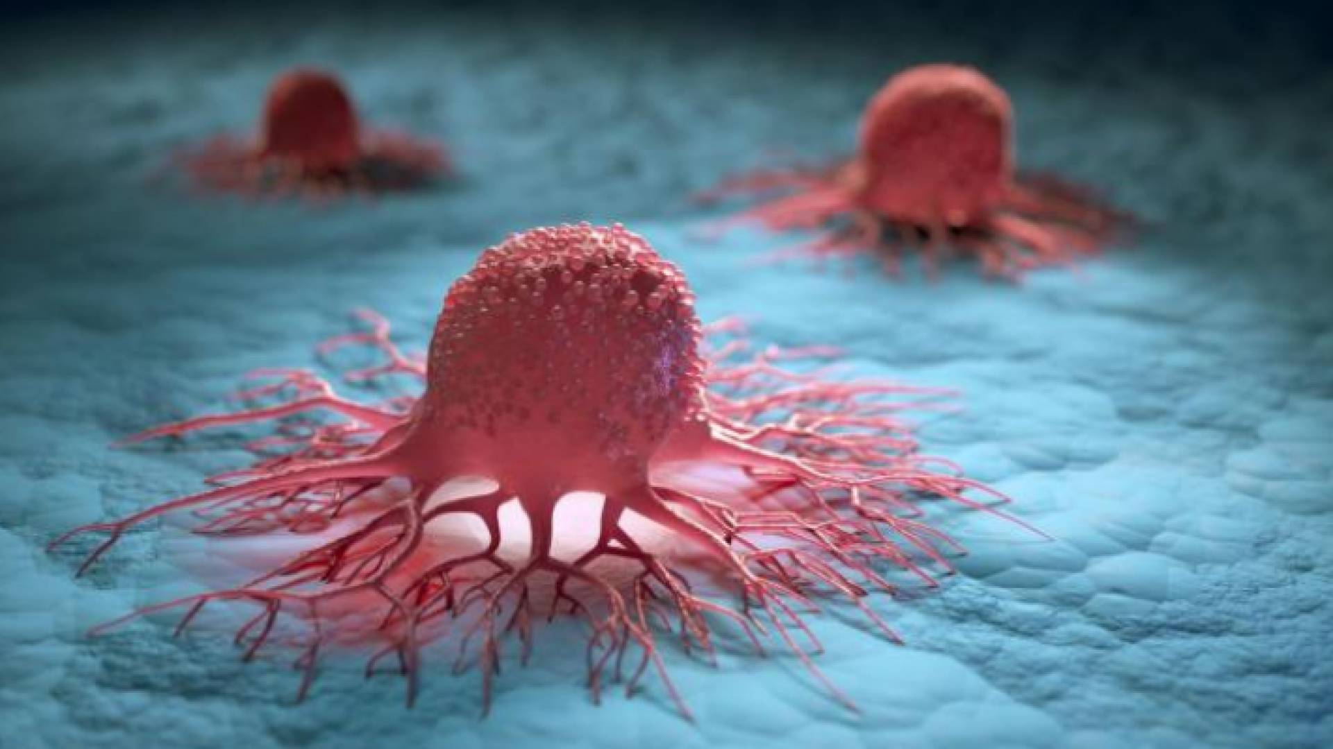 الأردن يسجل 6 آلاف إصابة بالسرطان سنويا