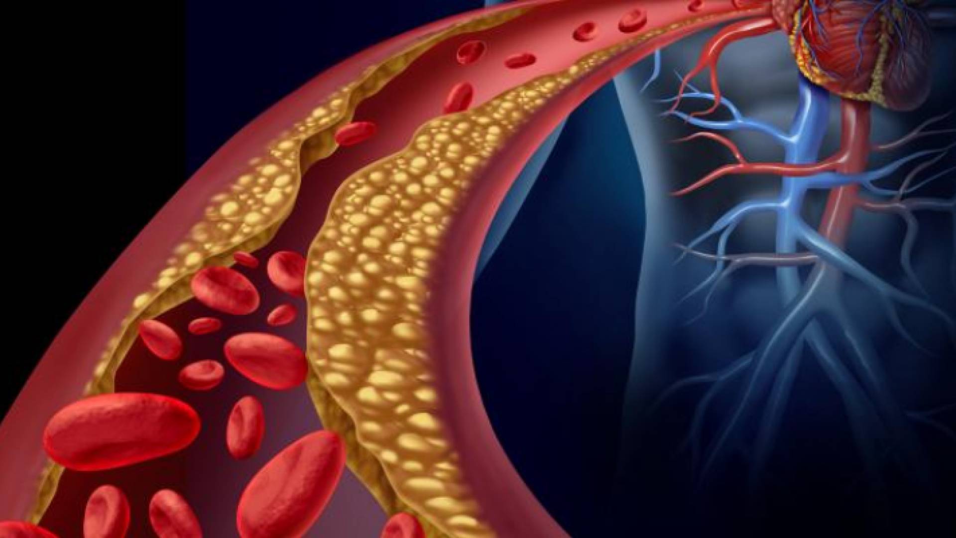 الصورة تعبيرية