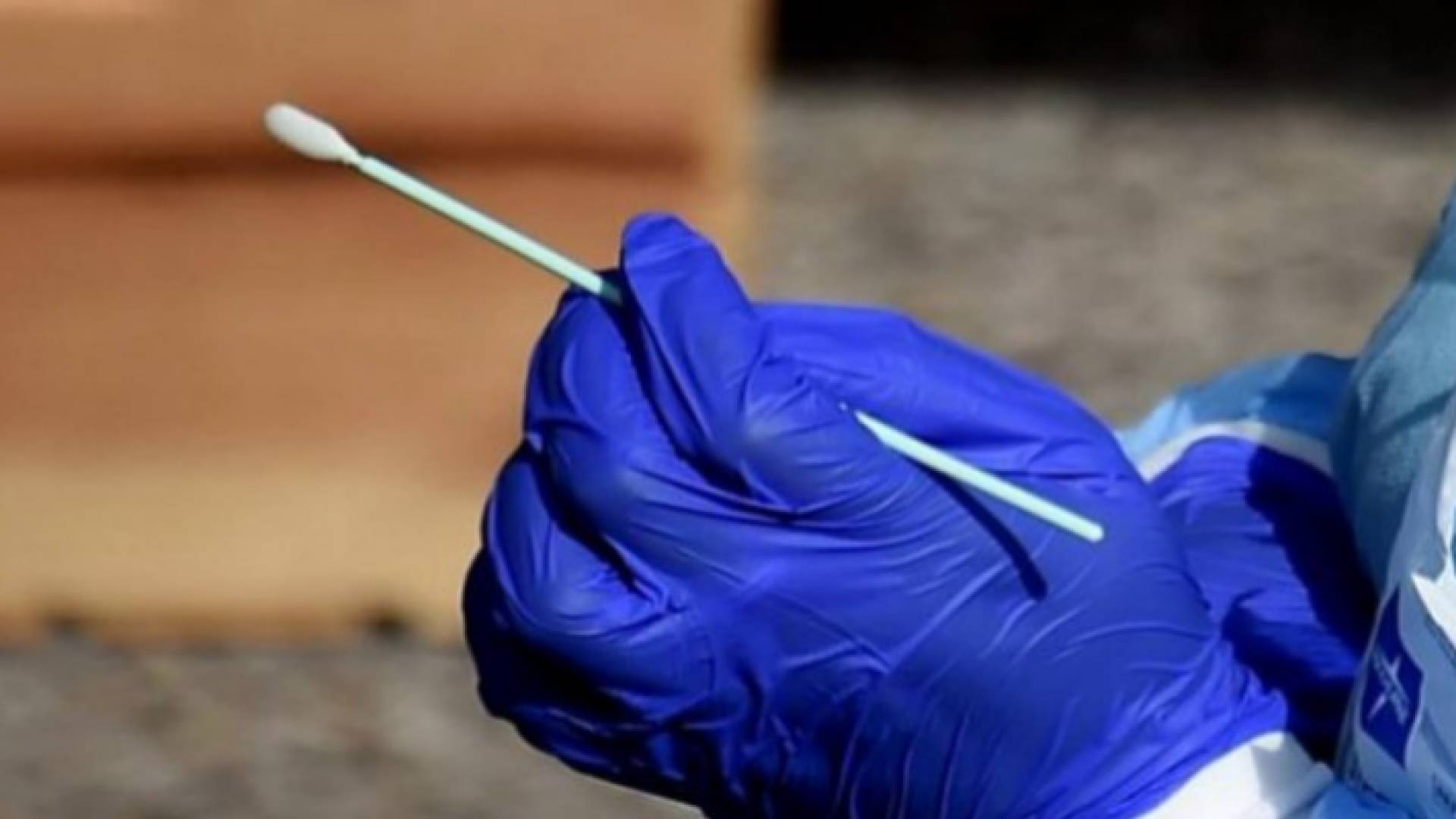 فحص كورونا - أرشيفية