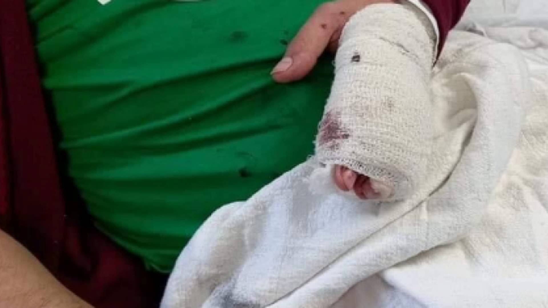 الاعتداء على سائق "توصيل طلبات" وتقطيع أصابعه