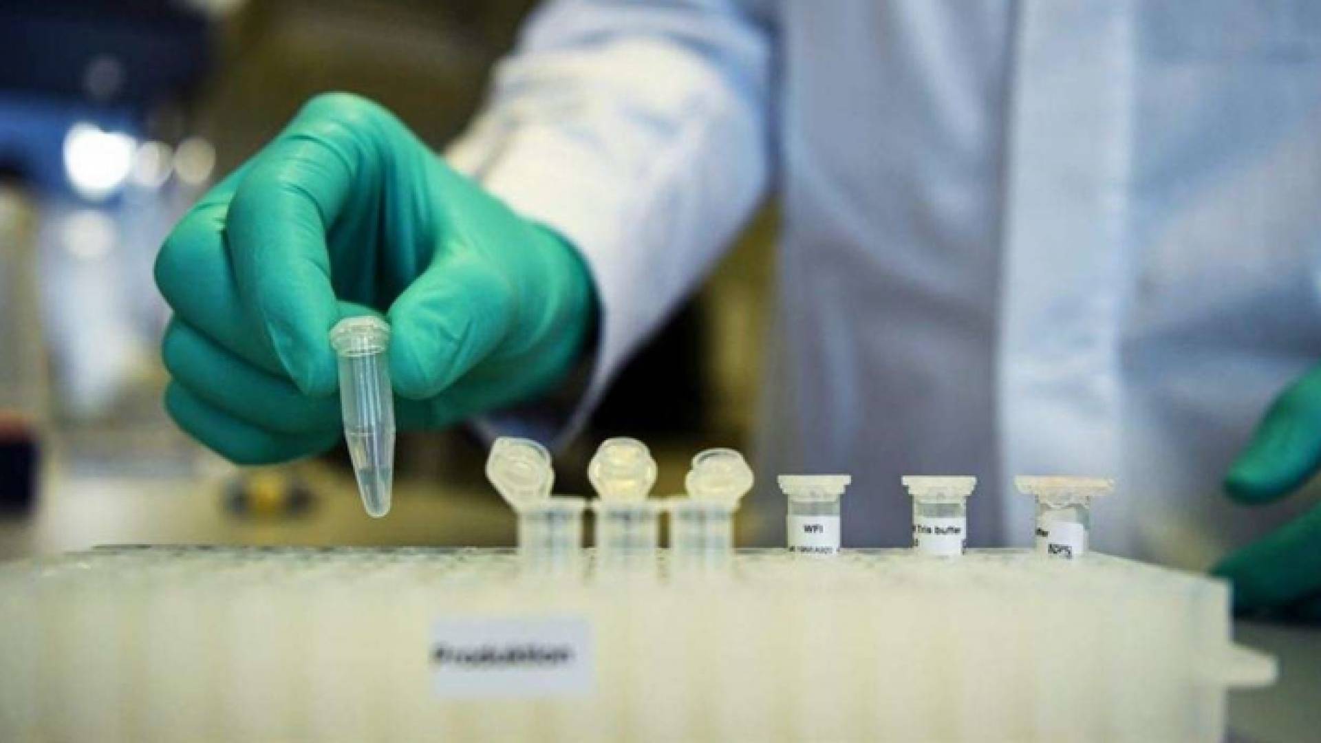 تطوير لقاح كورونا في أحد المختبرات بروسيا