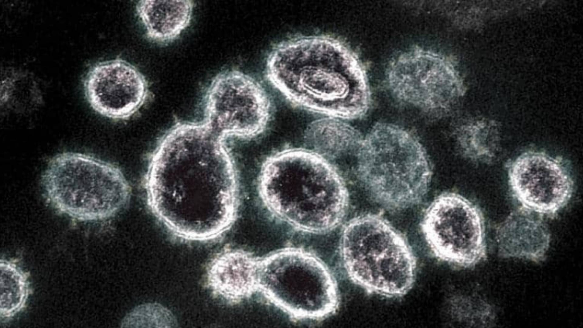 فيروس كورونا - تعبيرية