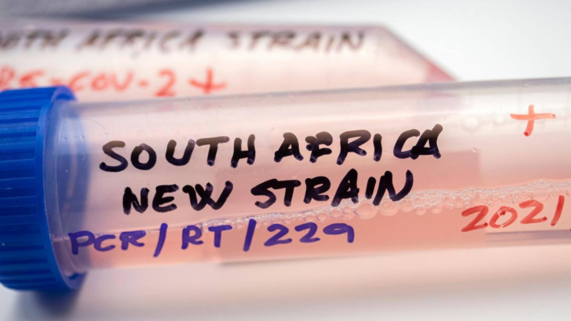 عينة فحص كورونا