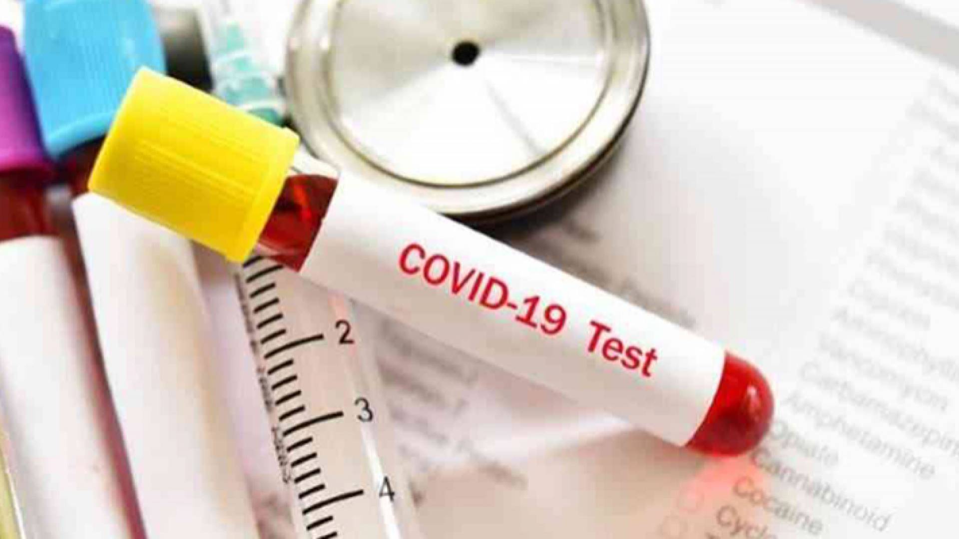 فحص كورونا - أرشيفية