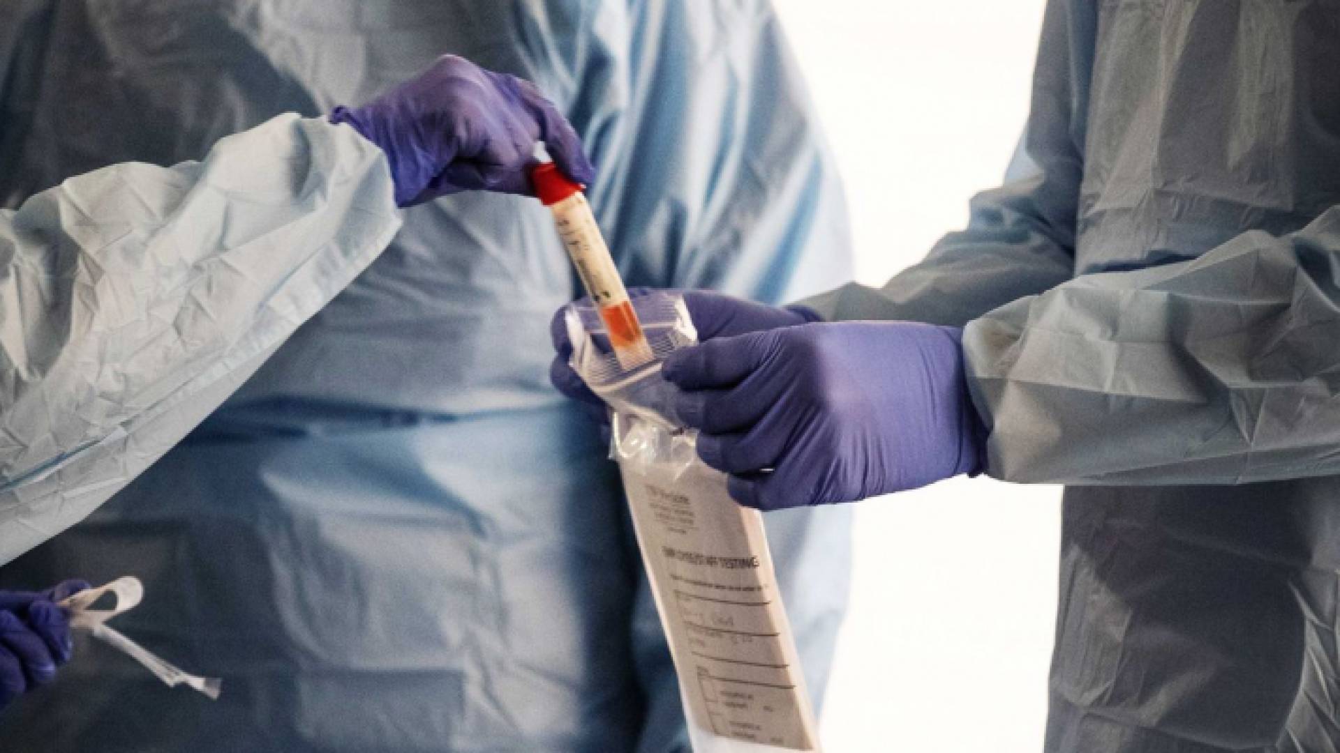 عينة فحص كورونا