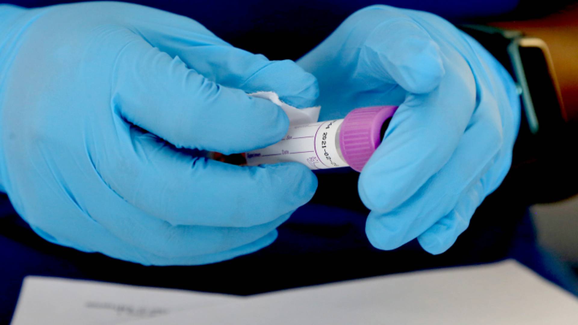 عينة كورونا - أرشيفية