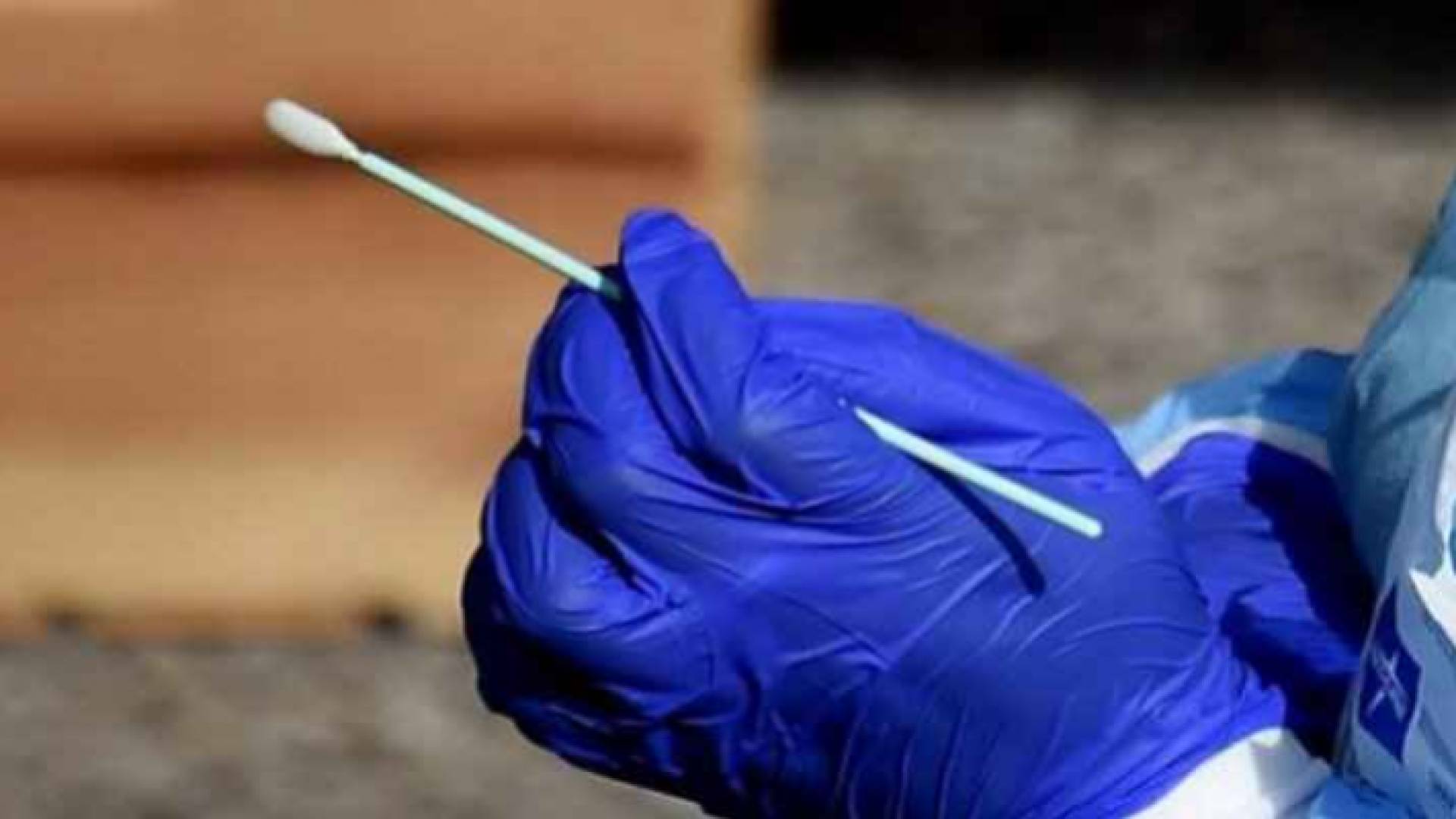 فحص PCR - تعبيرية