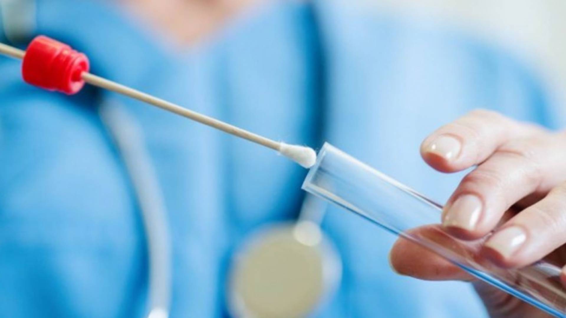 عينة فحص "بي سي آر"