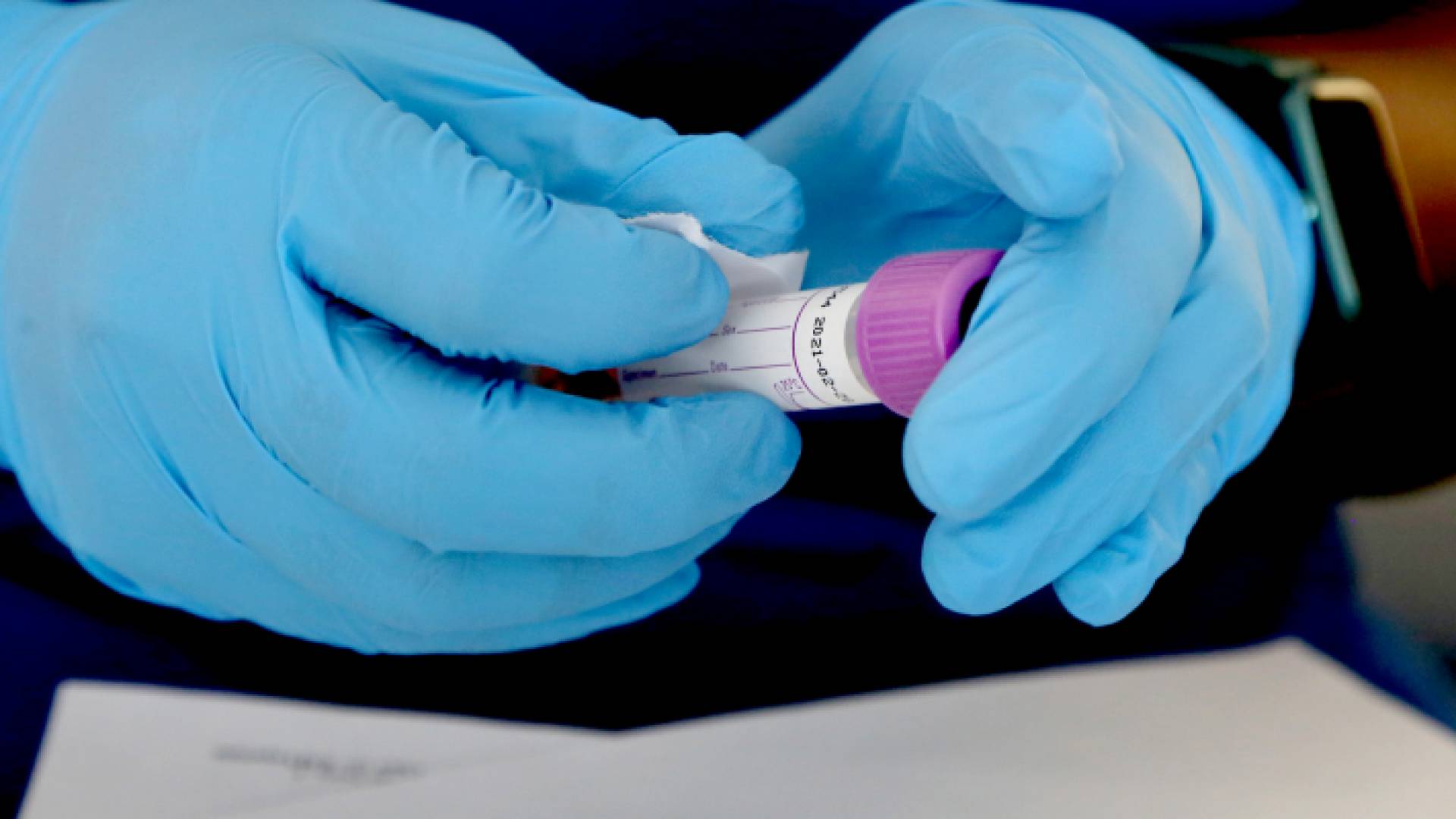 عينة فحص "بي سي آر"