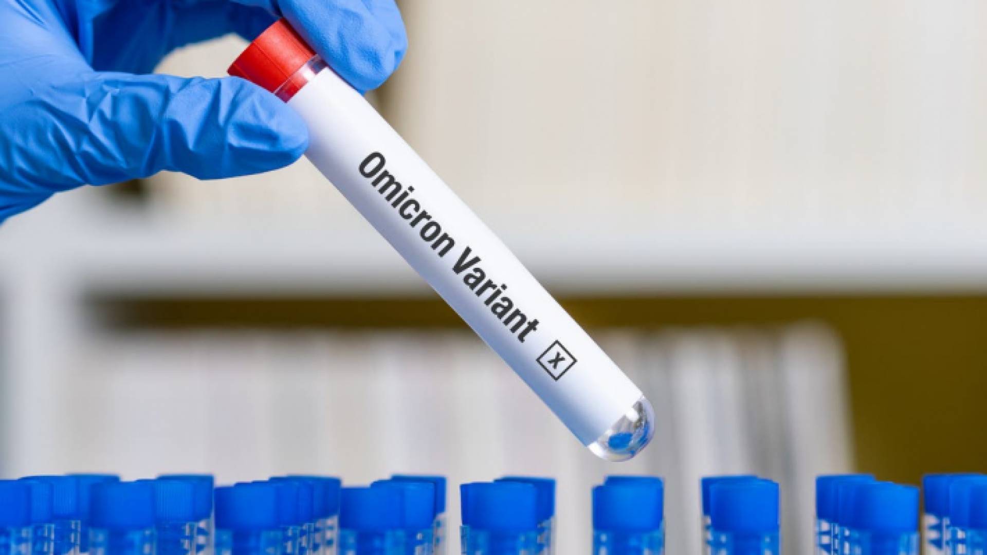 عينة فحص كورونا