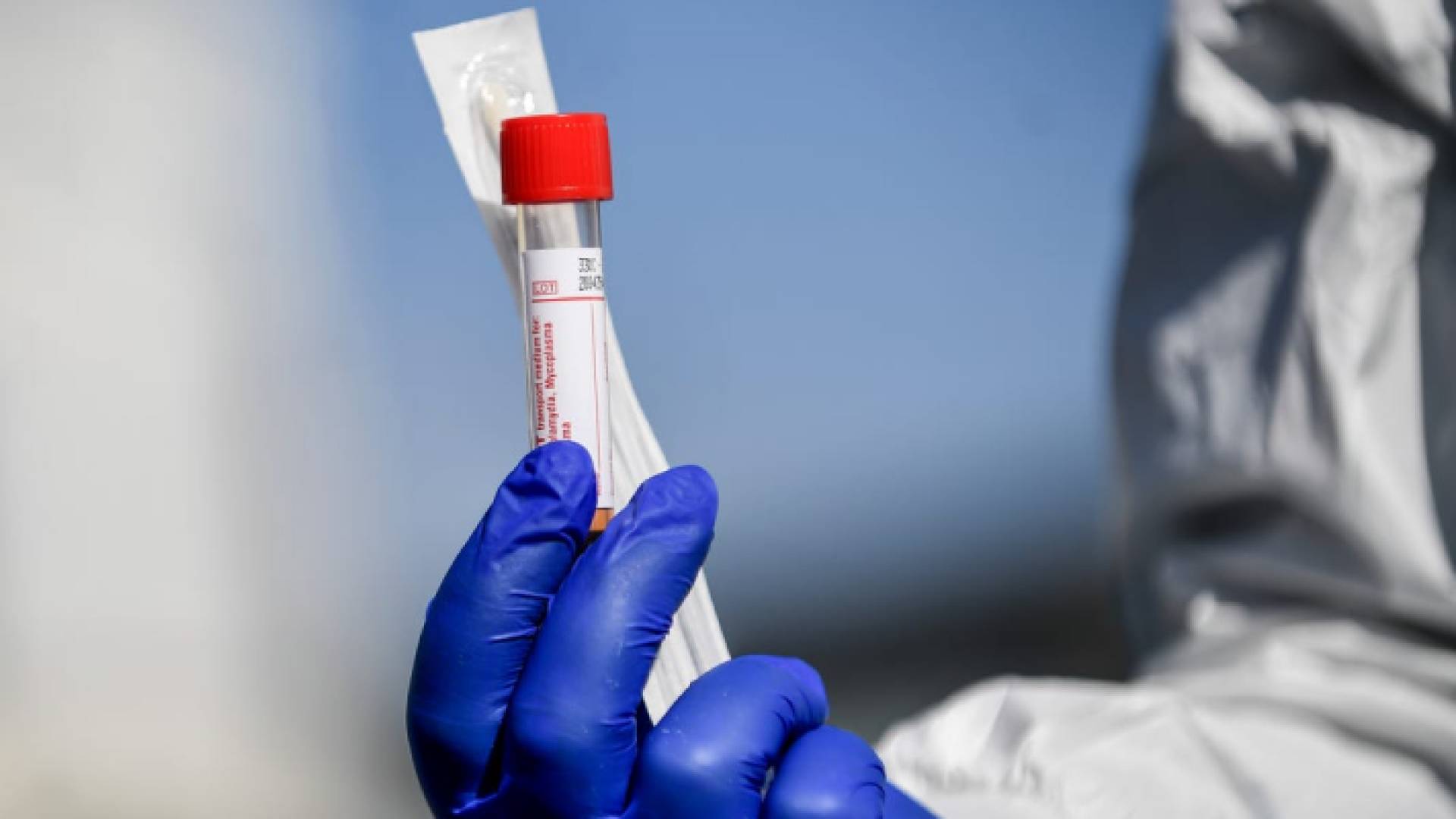 عينة فحص "بي سي آر"