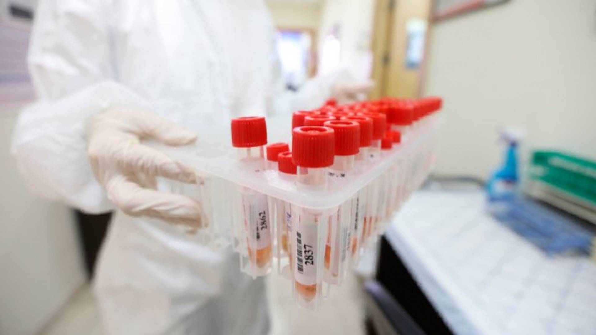 فحوص كورونا - أرشيفية