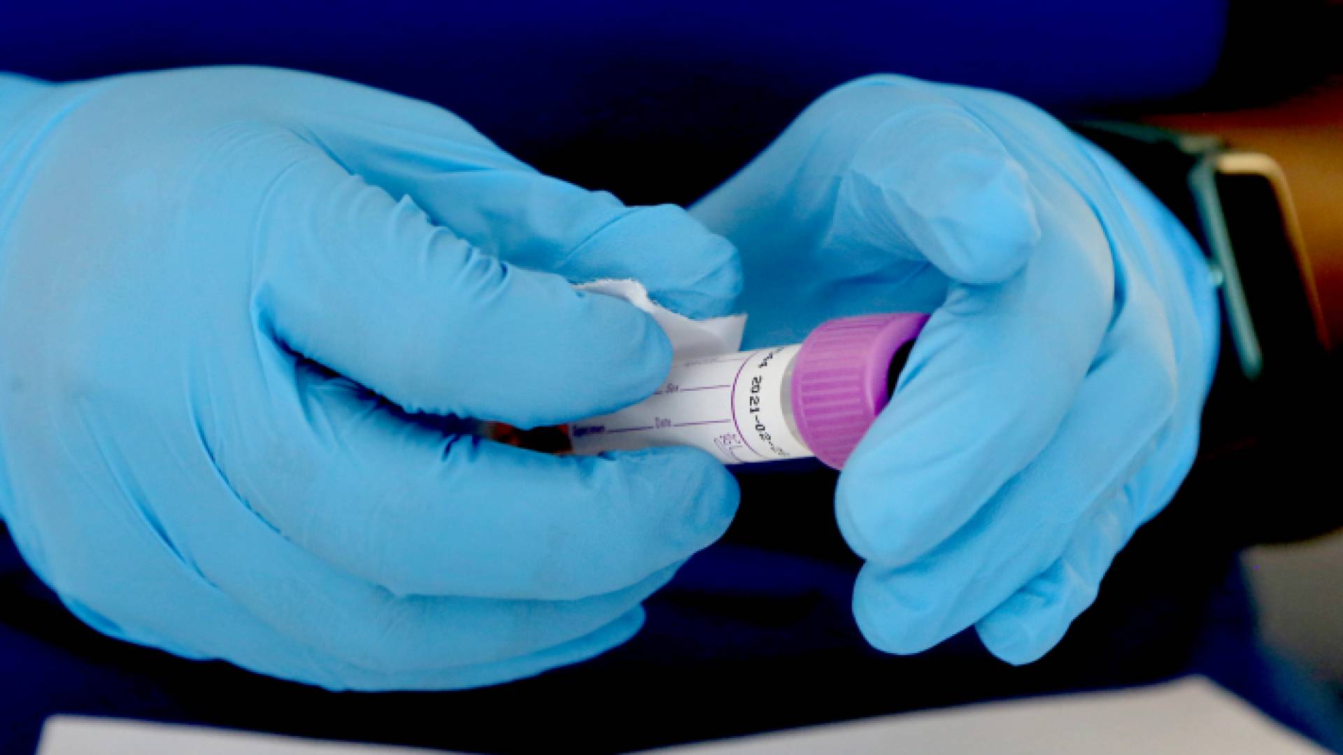 عينة فحص "بي سي آر"