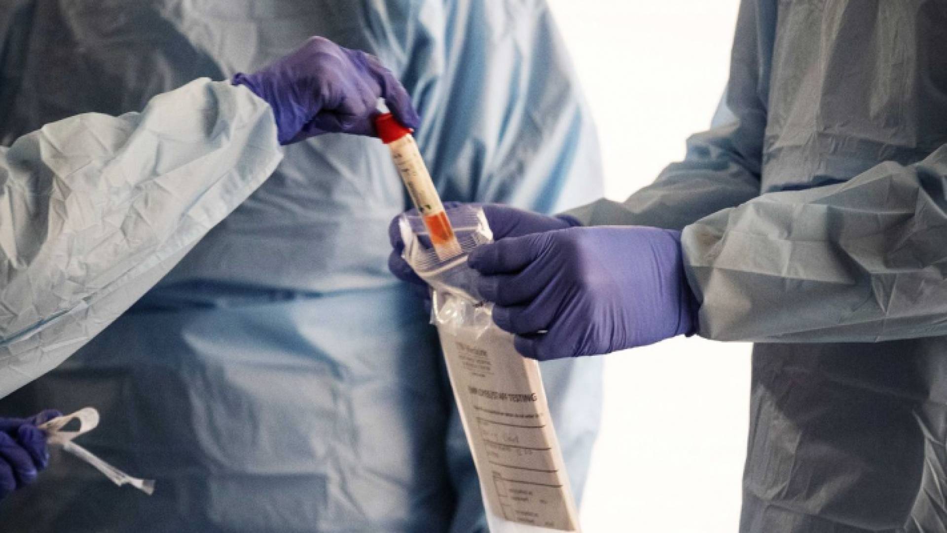 عينة فحص "بي سي آر"