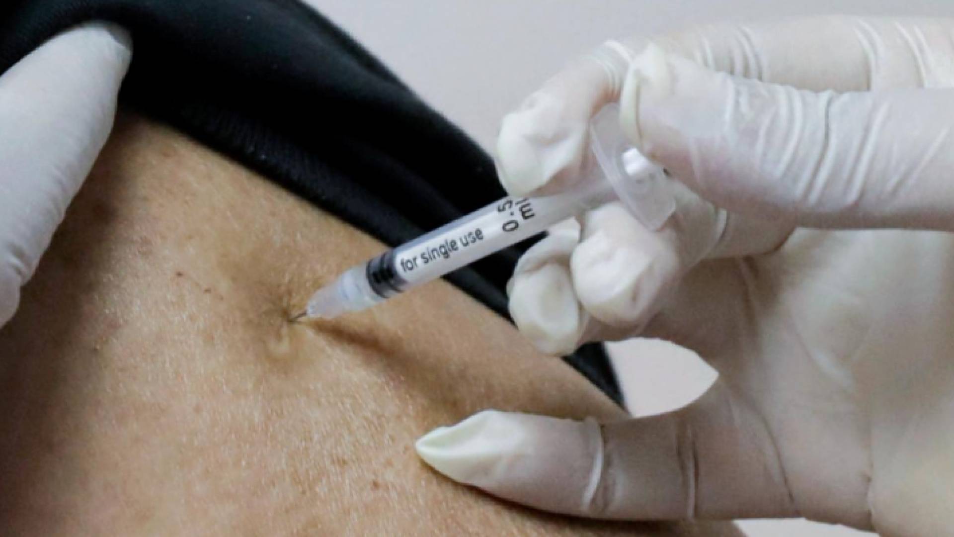 تلقي لقاح كورونا