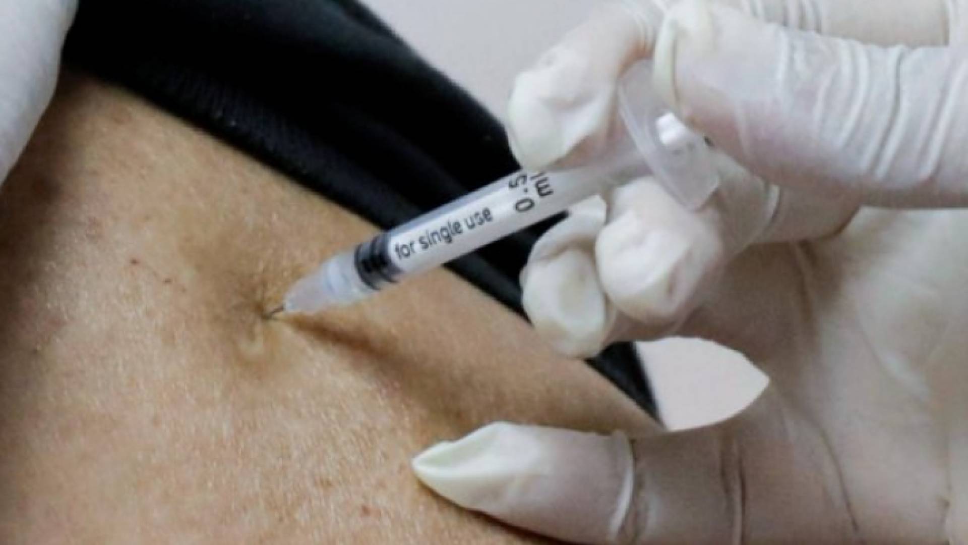 تطعيم كورونا