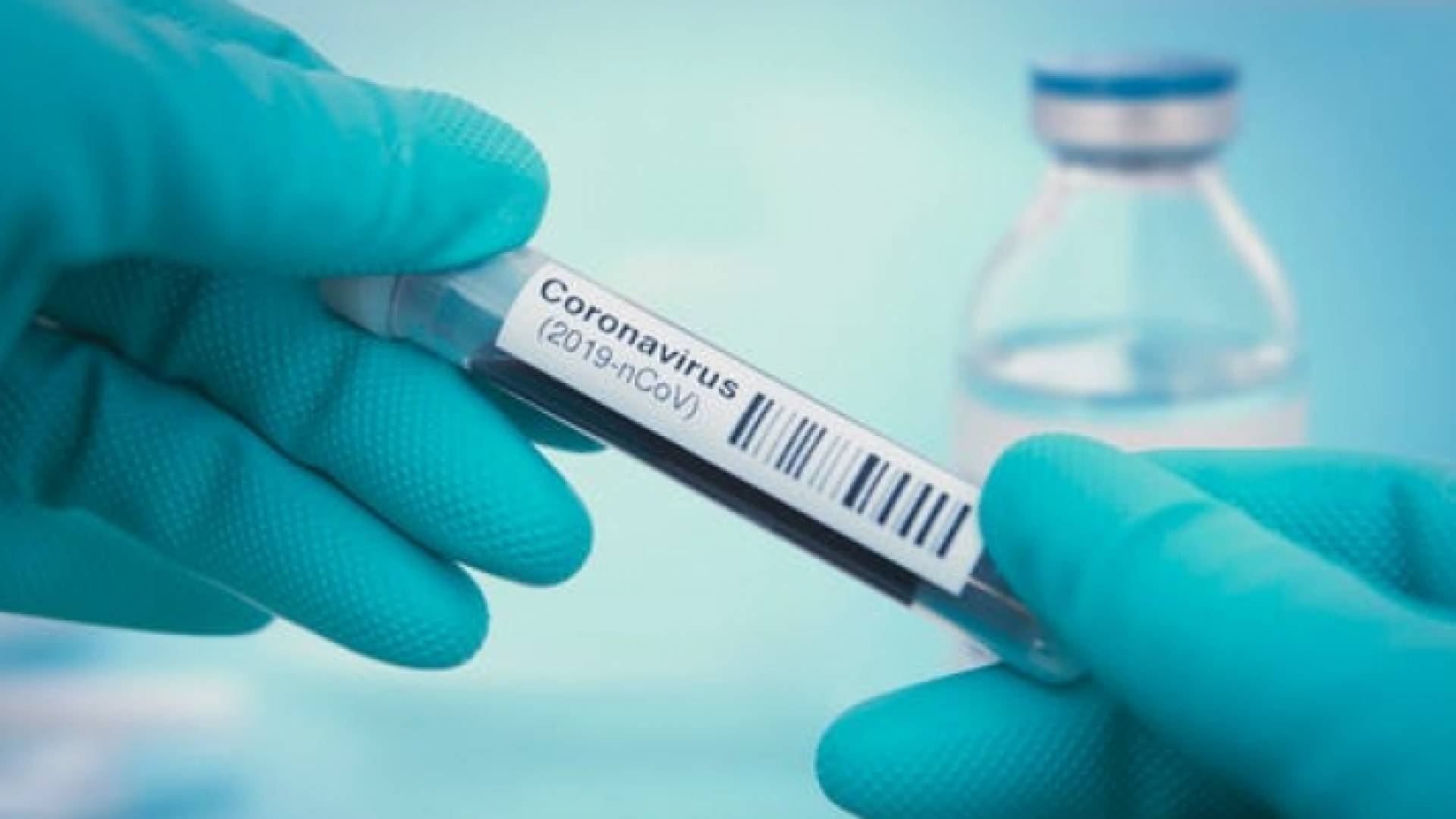 عينة فحص كورونا