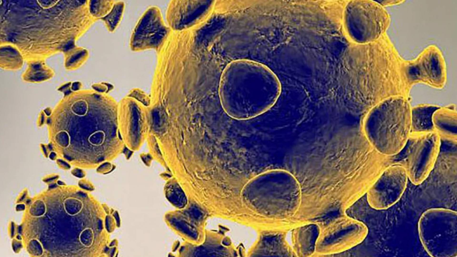 صورة تجسد شكل فيروس كورونا