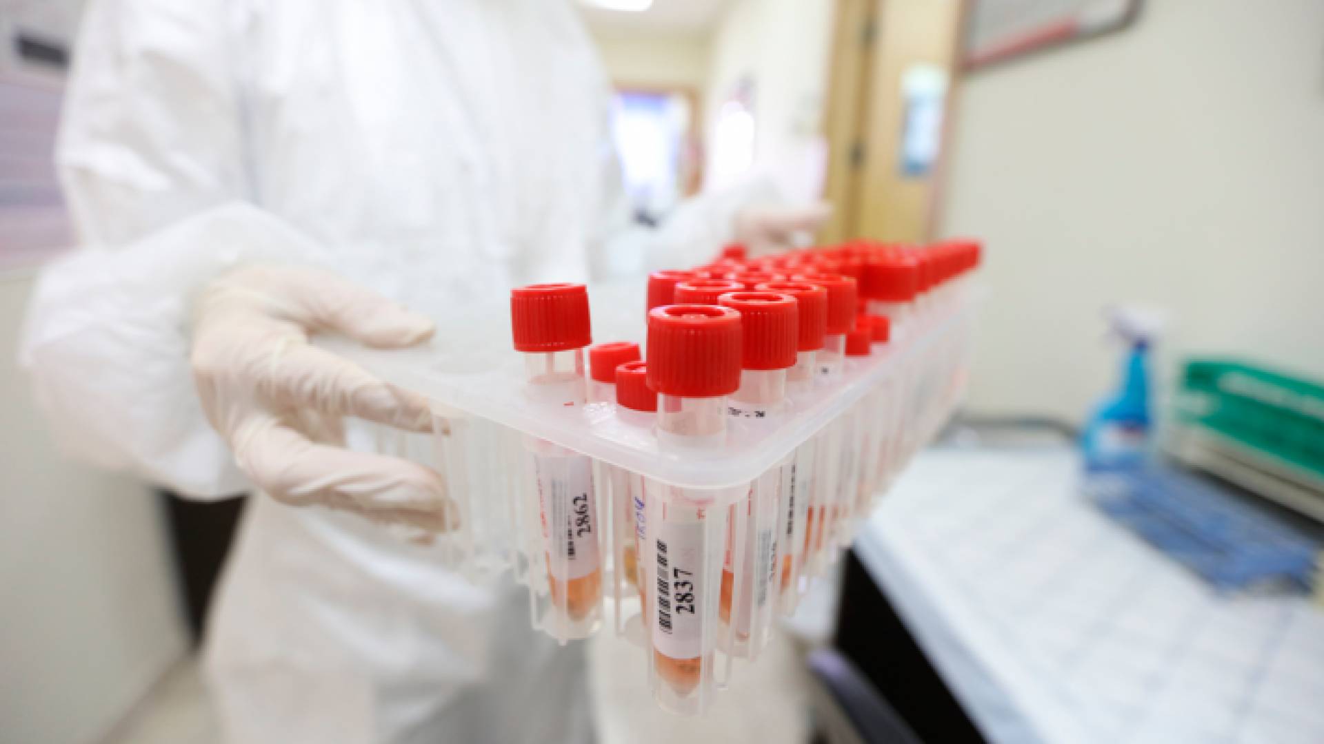 عينات فحص كورونا