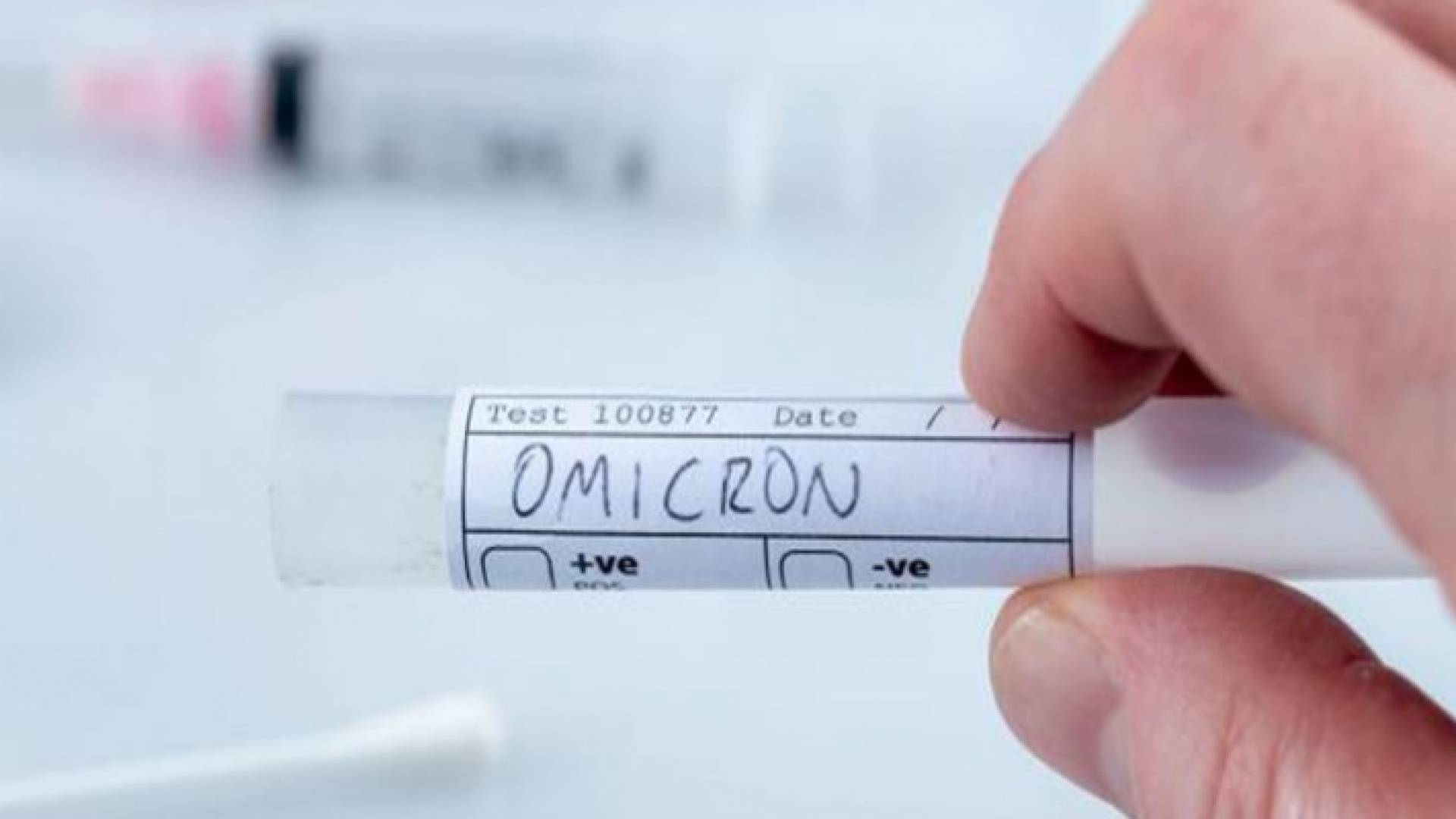 فحص فيروس أوميكرون - ارشيفية