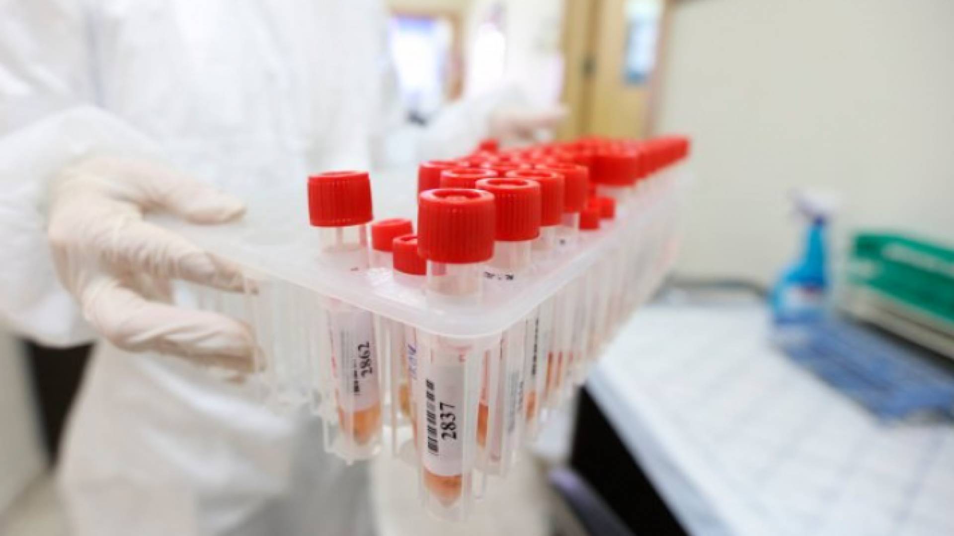 عينات فحص كورونا - أرشيفية