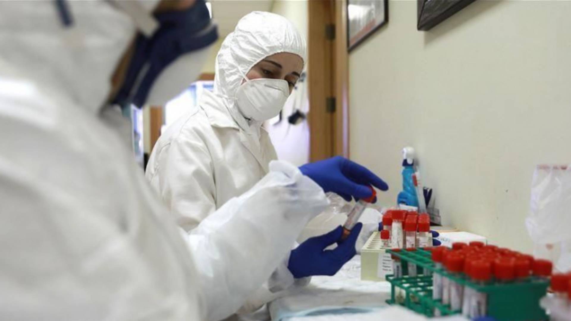 عينات فحص كورونا