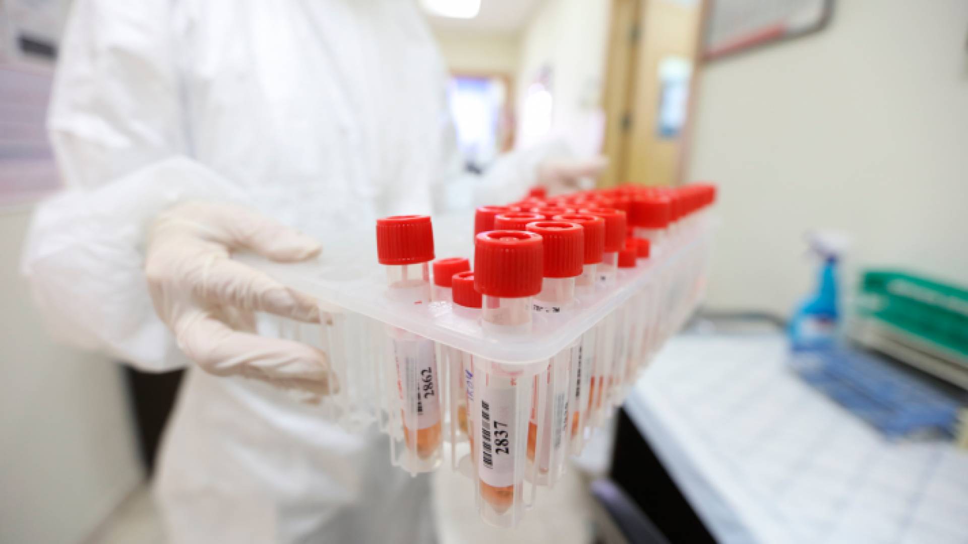 عينات من فحص كورونا