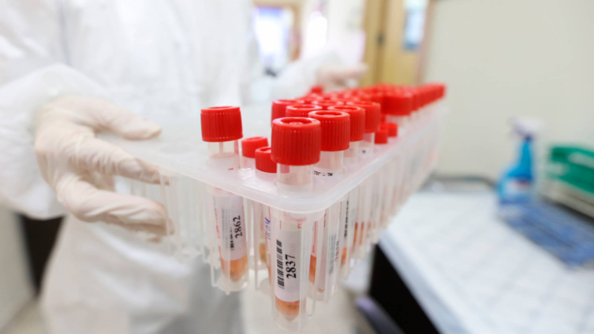 فحوص كورونا