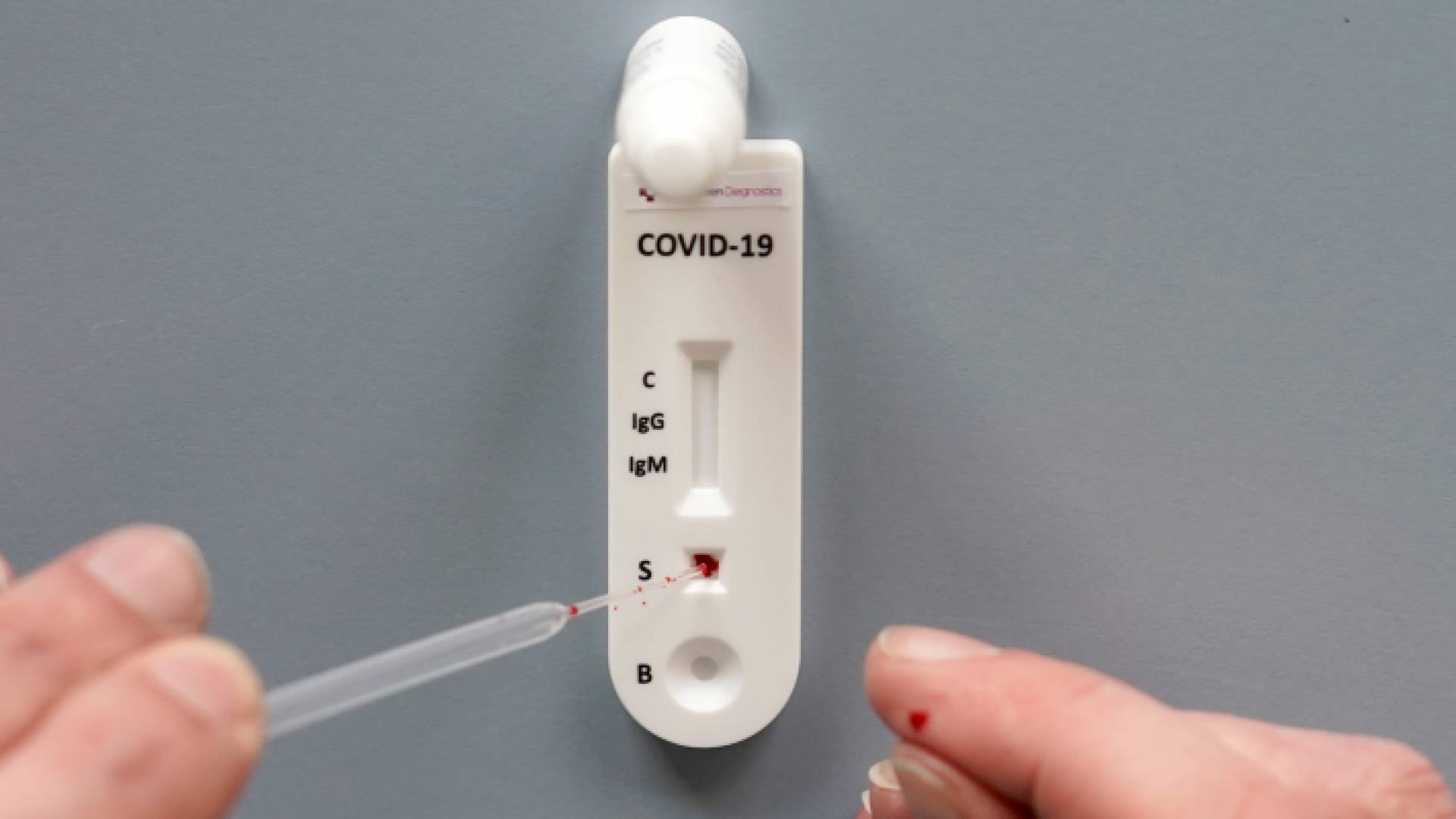 فحص كورونا السريع