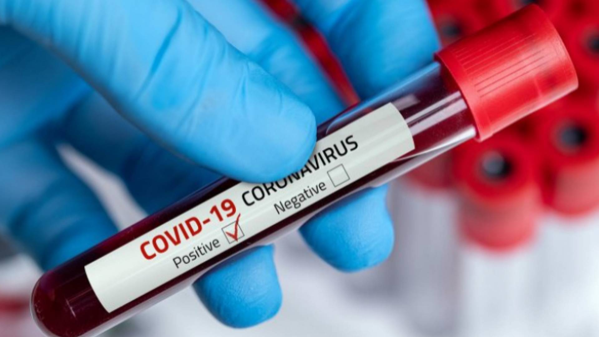 فحص كورونا "إيجابي"