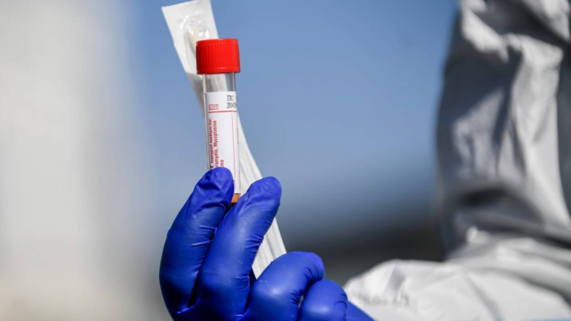 فحص "بي سي آر"