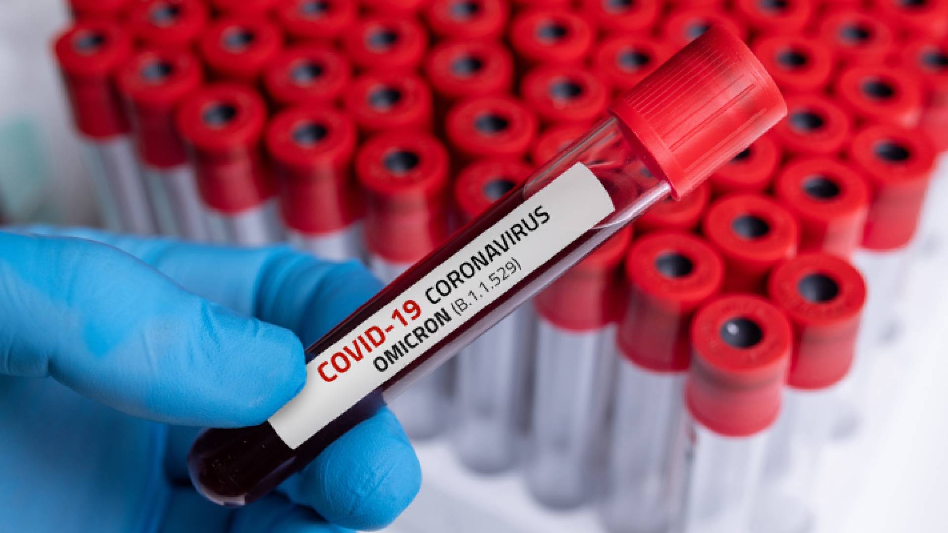 فحوصات "بي سي آر"