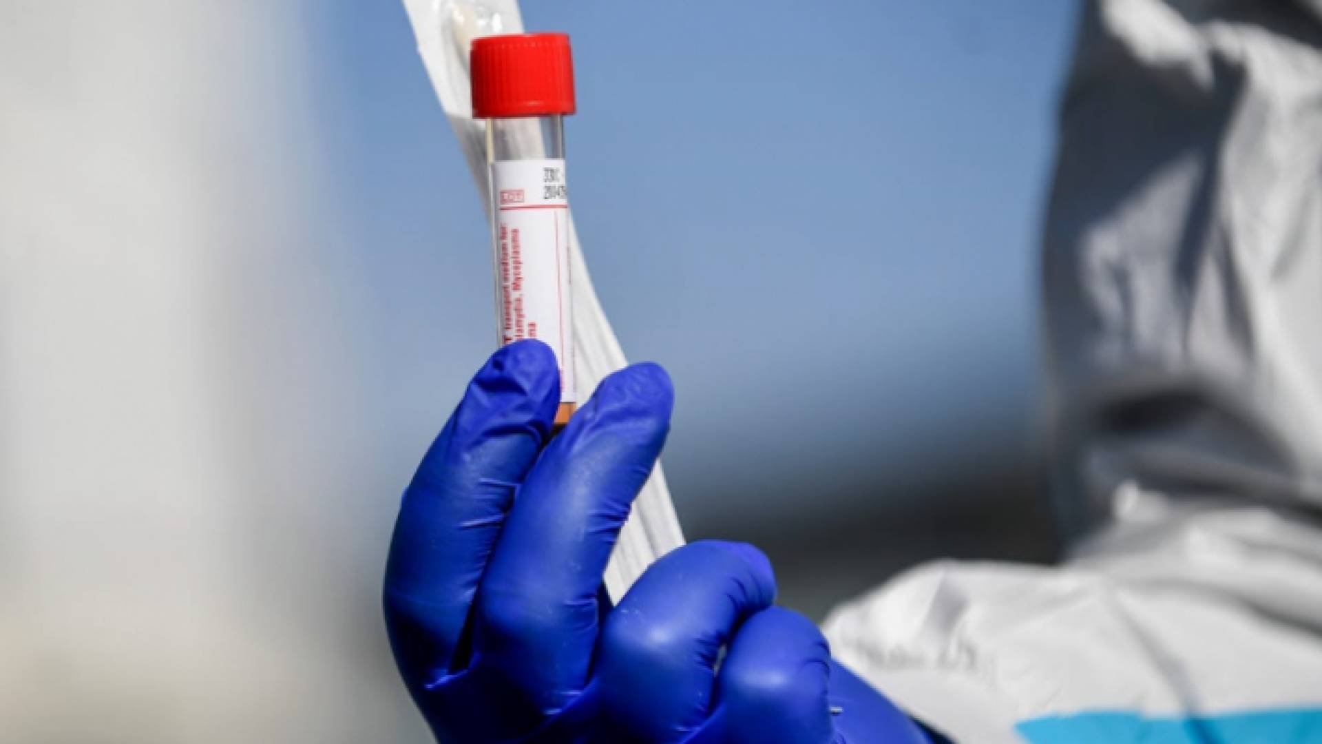 فحص كورونا - أرشيفية