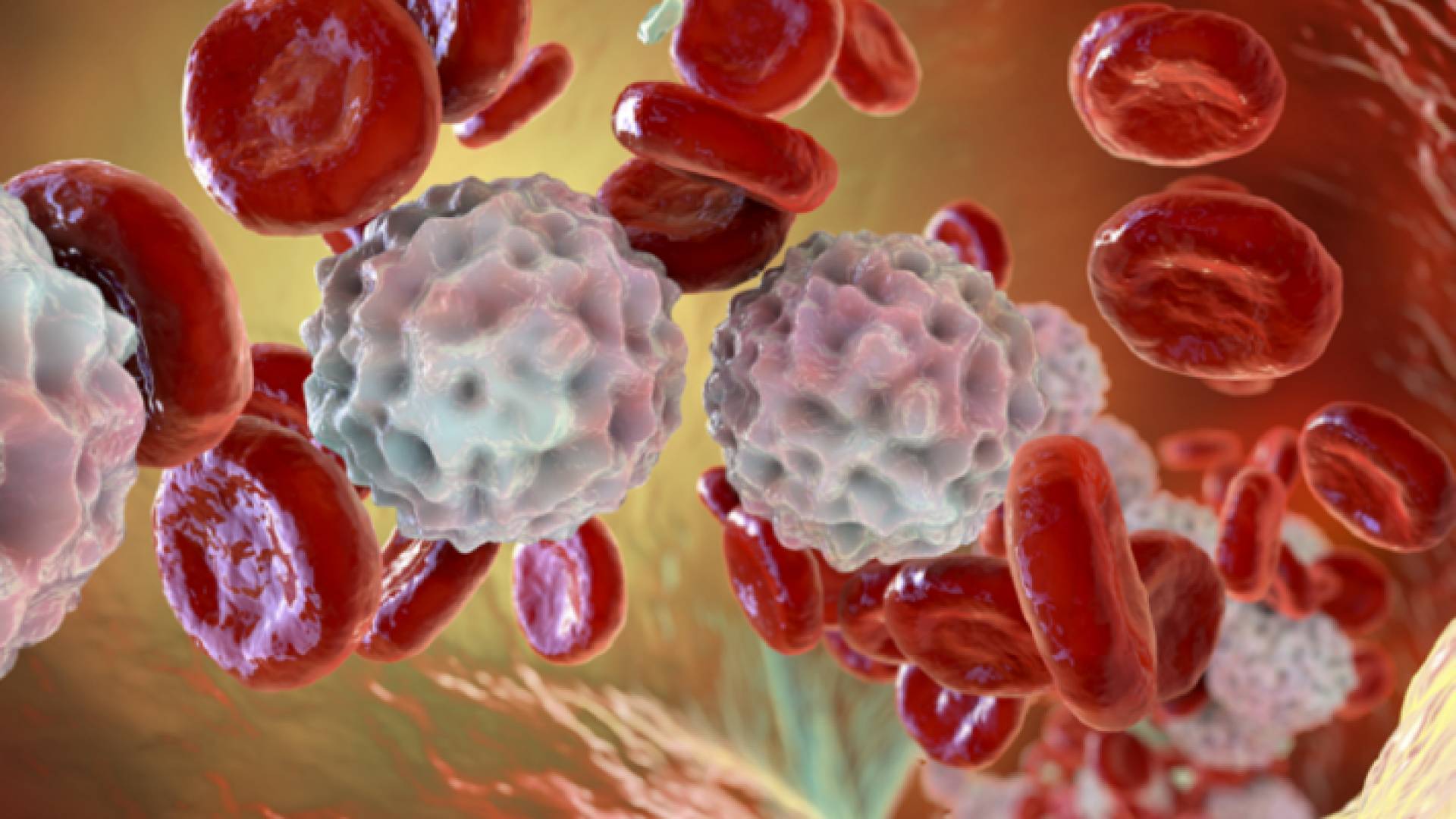 مقطع توضيحي لمرض السرطان