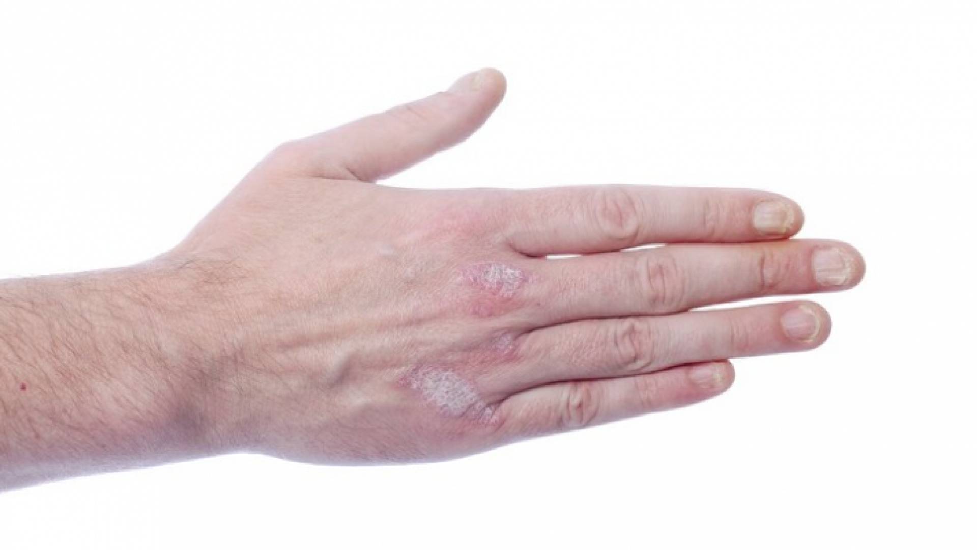 يد تعاني أعراض كورونا