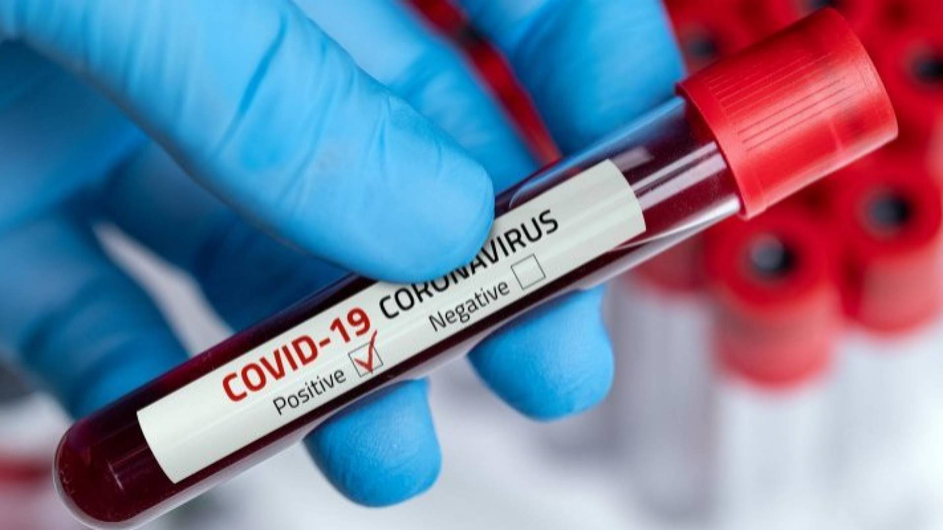 حبس 3 موظفين بمختبرات خاصة 6 أشهر لتلاعبهم بنتيجة فحوصات كورونا