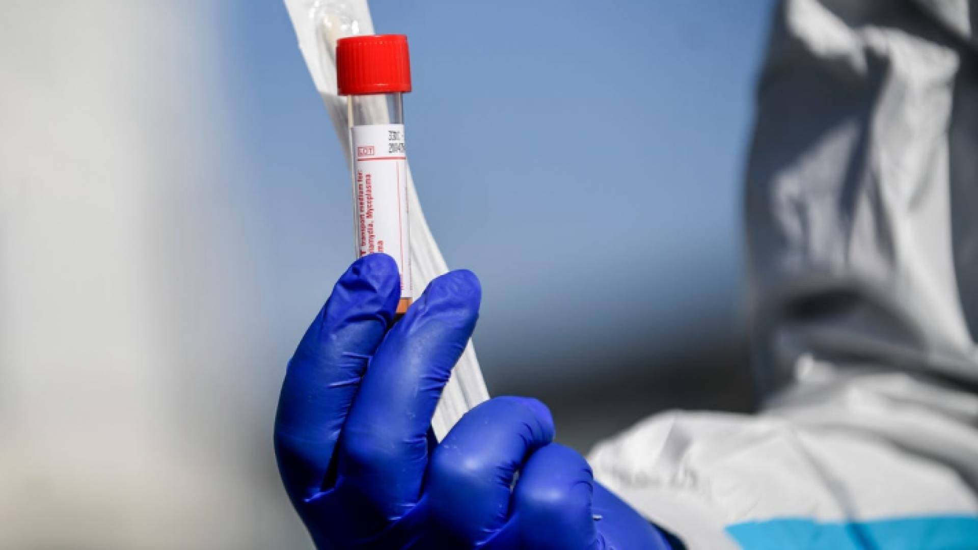 عينة فحص "بي سي آر"