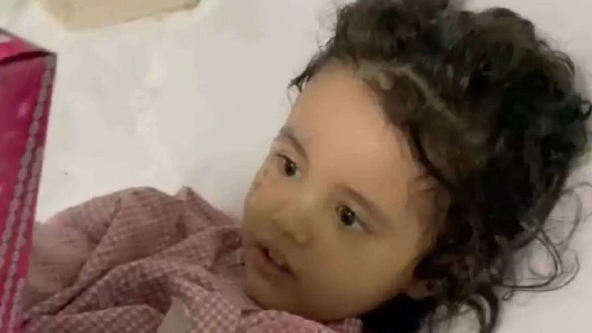 الطفلة ضحية الأسيد - نقلا عن العربية