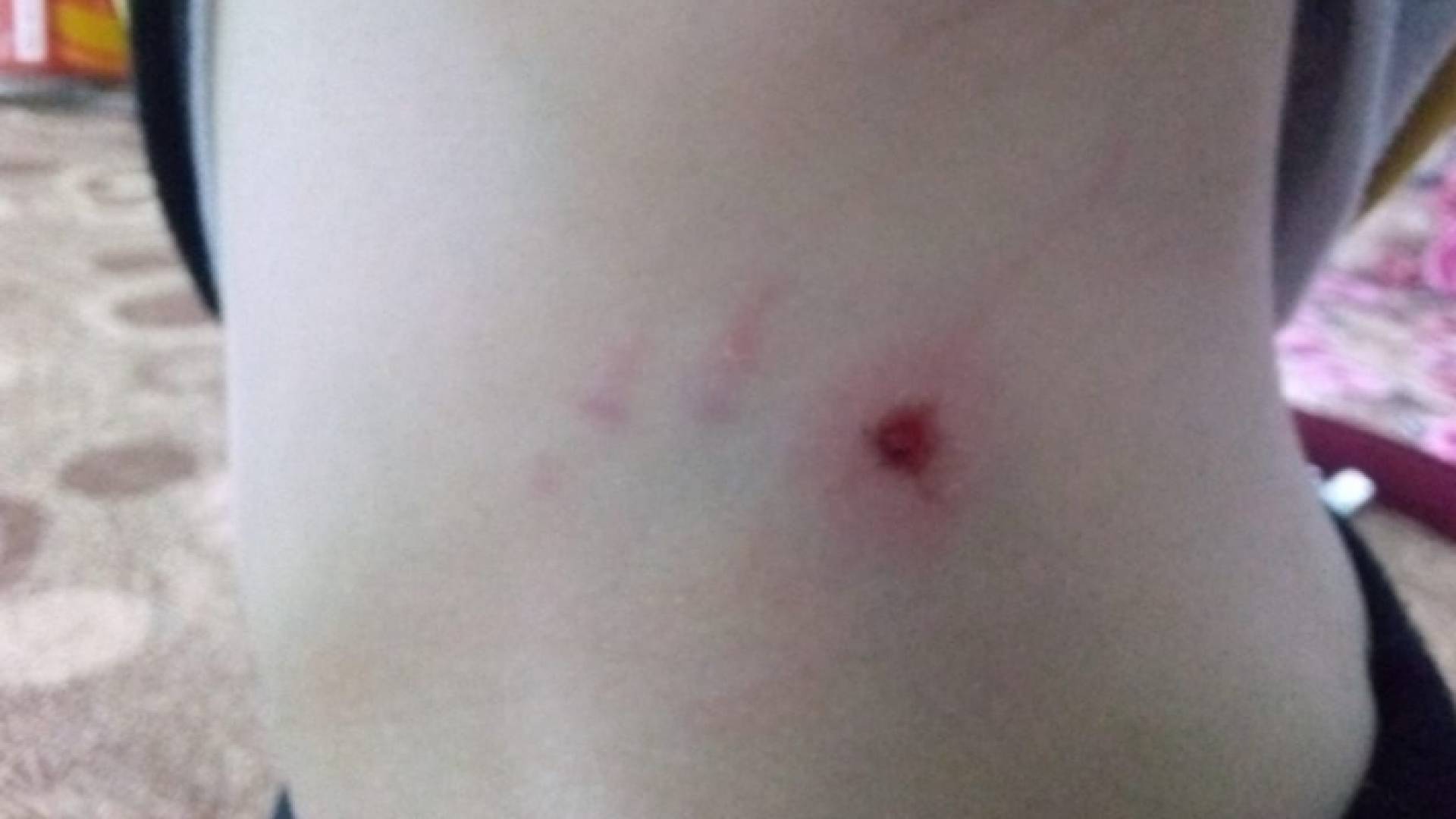 كلاب ضالة تنهش طفلة في المفرق