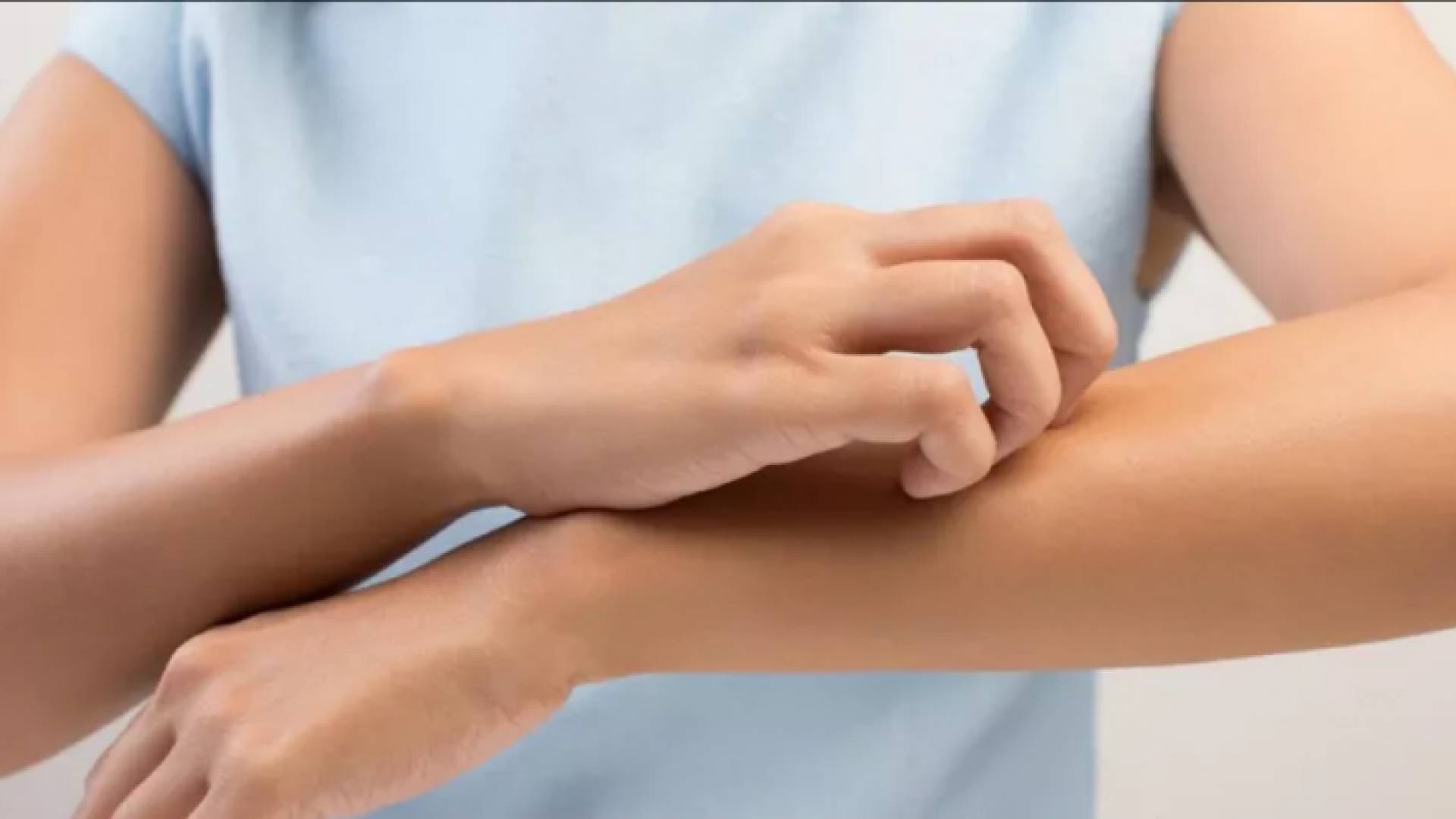 ماذا يعني الشعور بالحكة ليلاً؟