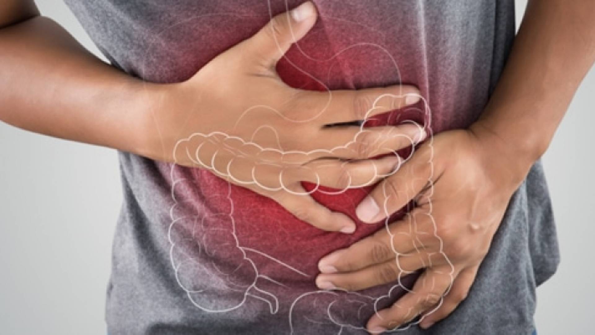 القولون العصبي - تعبيرية