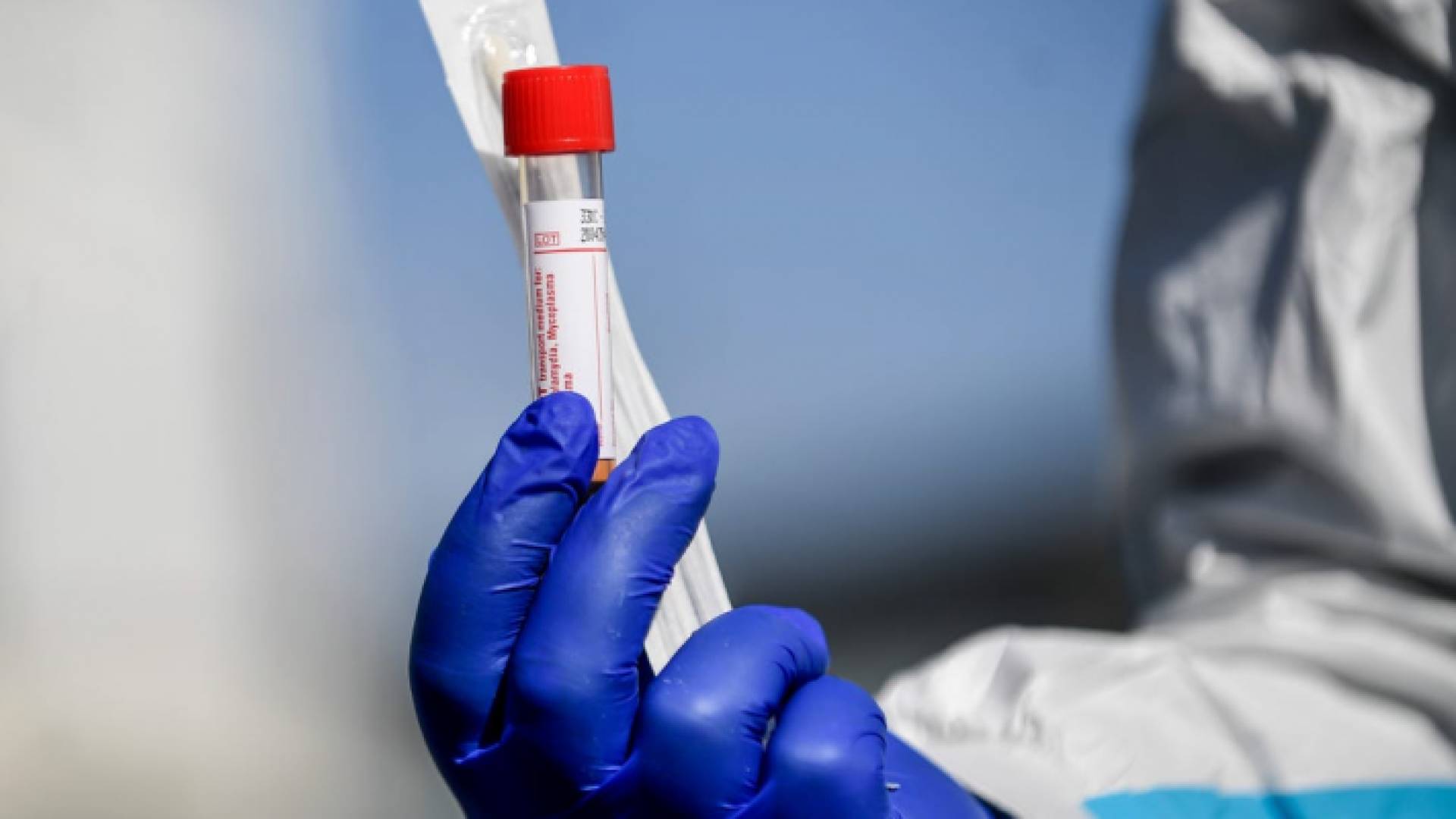 عينة فحص "بي سي آر"