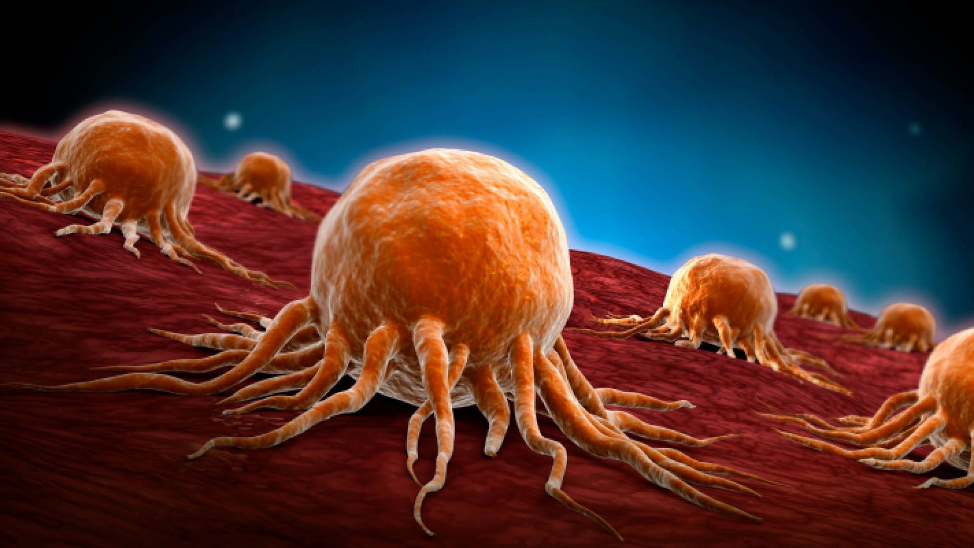 مقطع توضيحي لخلايا سرطانية