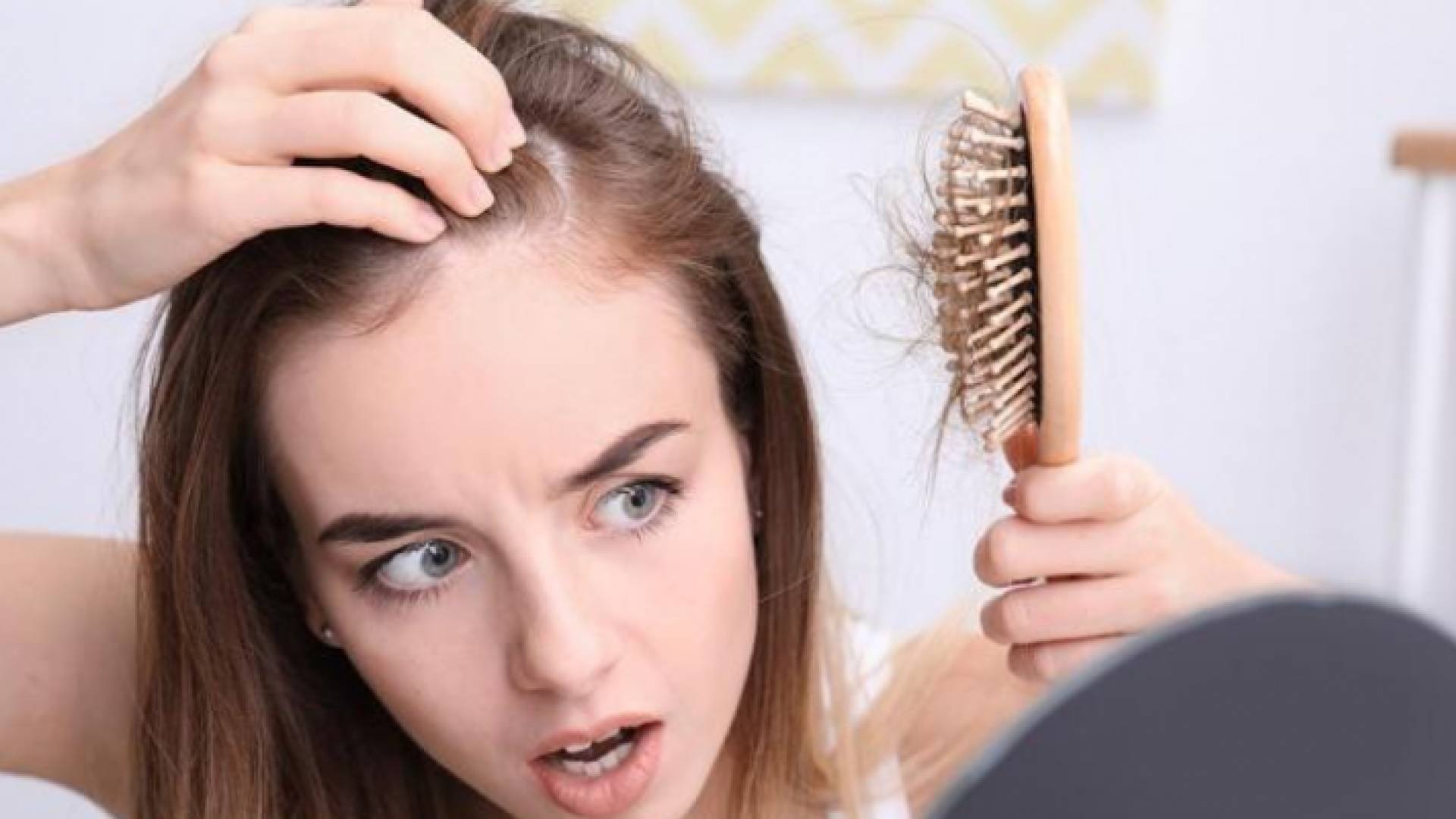 تساقط شعر - تعبيرية