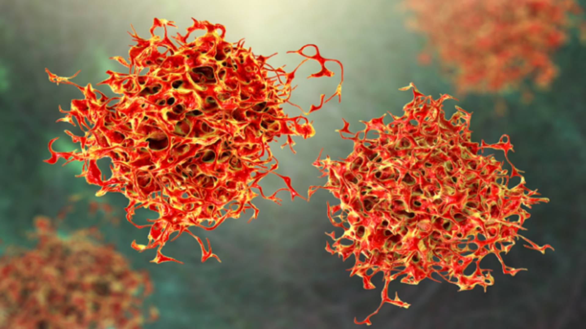 مقطع توضيحي لخلايا سرطانية