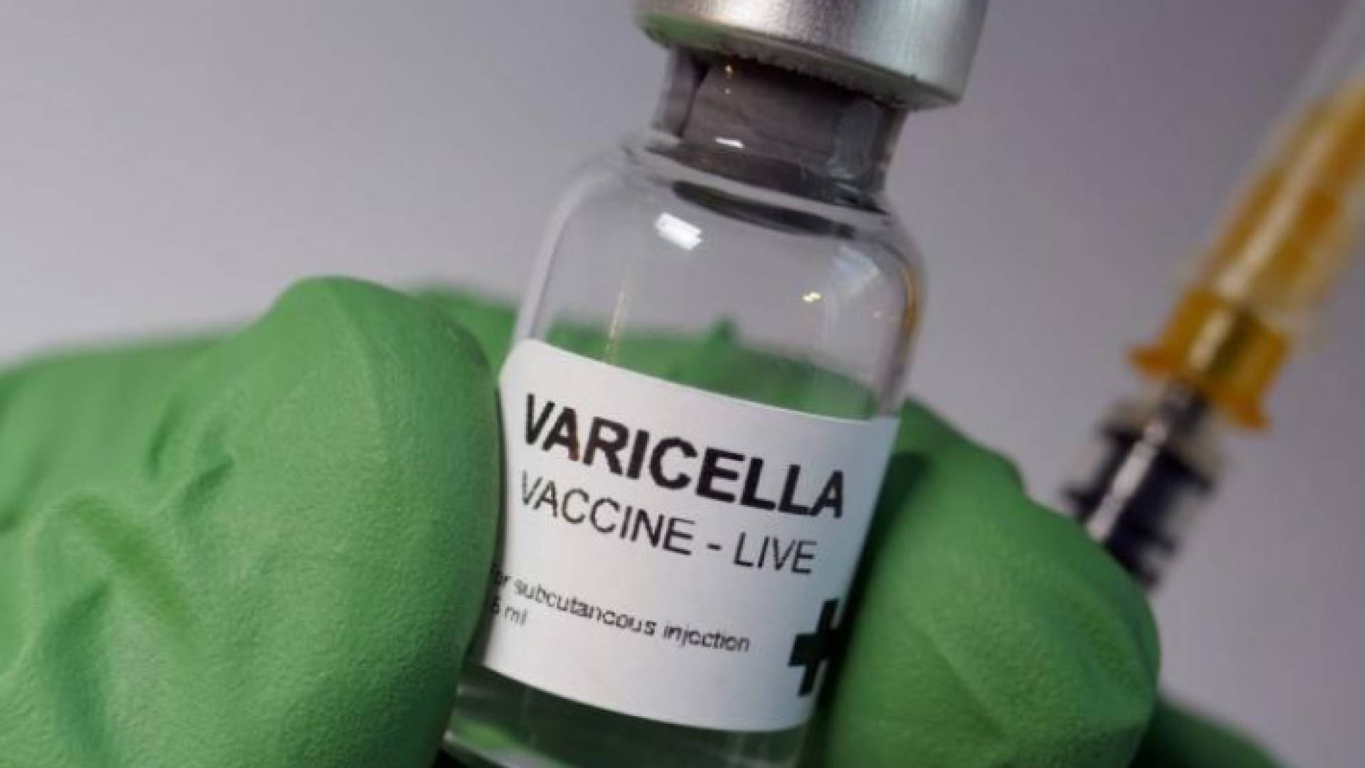 لقاح الجديري المائي